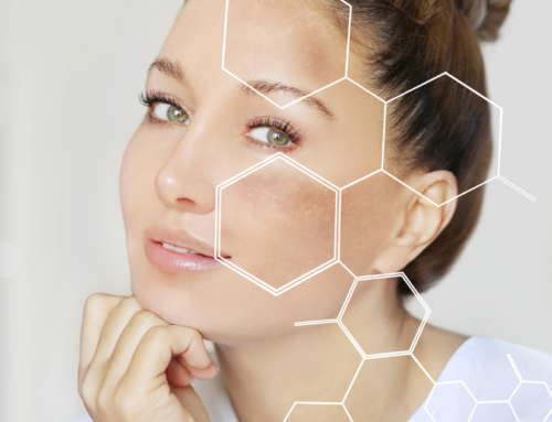 4 common myths about hyperpigmentation